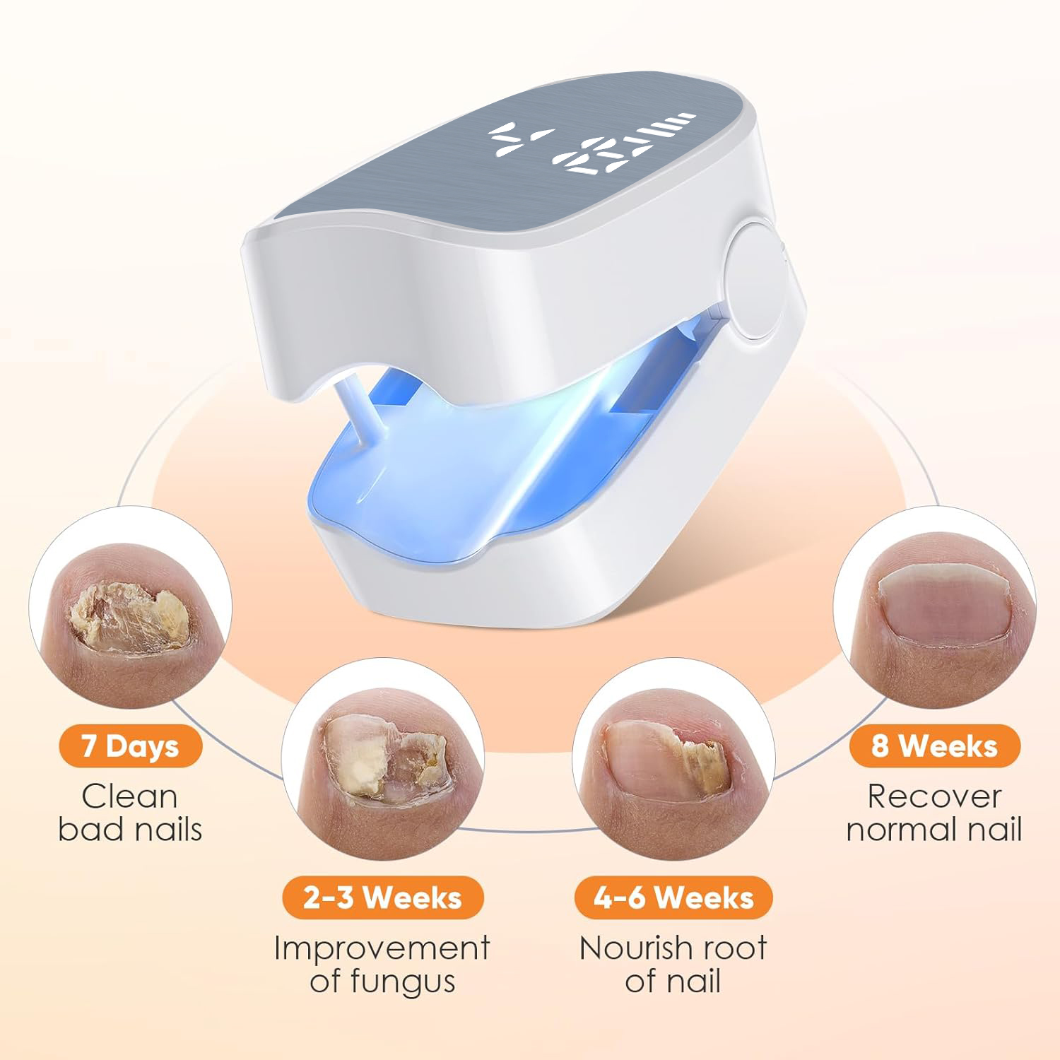 1 stks Effectieve Oplaadbare N - Industrial Laser Removal recensie en prijs