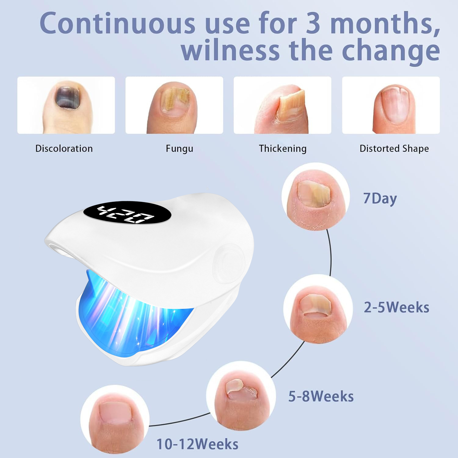 Effectieve laserfototherapiela - Industrial Laser Removal recensie en prijs